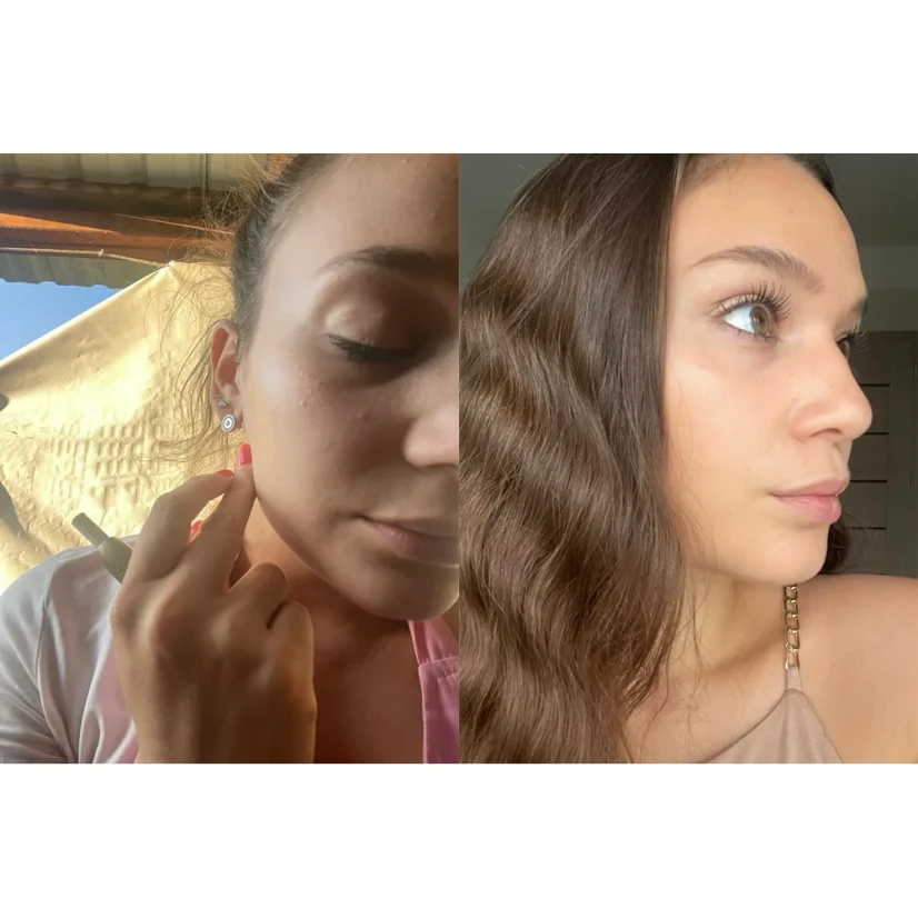 Před | Po